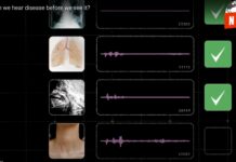 ¡Revolucionaria IA de Google detecta enfermedades con solo escuchar tu tos!