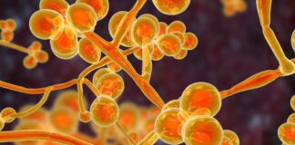 Hongo Cándida auris: La bacteria carnívora que preocupa a la comunidad médica mundial