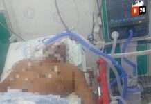 ¡Tragedia en la mesa: Adulto mayor muere por atragantamiento con carne de cerdo!