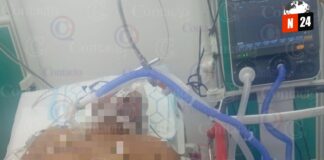 ¡Tragedia en la mesa: Adulto mayor muere por atragantamiento con carne de cerdo!