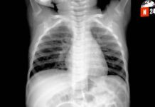 ¡Alerta viral! Descubre los secretos del misterioso virus que azota a China