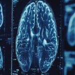 Fármaco para presión arterial revela poder contra tumores cerebrales